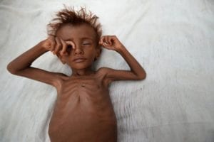 اليمن تودع طفلاً كل عشر دقائق