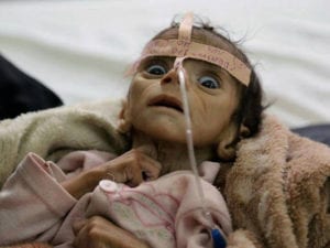 اقرعوا الأجراس.. المجاعة تقتل اليمنيين
