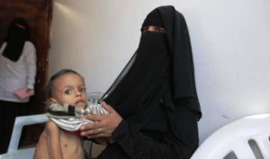 يونيسيف: الحرب في اليمن تسببت بمقتل 1400 طفل