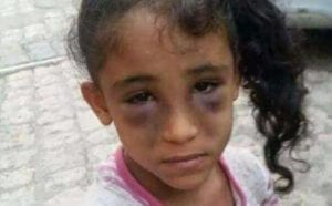 طفلة يمنية تضرب عن الطعام وتنجح فى الإنتصار لقضية "شمياء" فى صنعاء