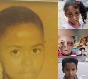 "السوشيال ميديا" تنتصر لقضايا الأطفال فى اليمن