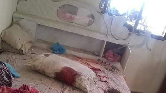 تعز: مقتل امرأة وإصابة ثلاثة آخرين بقذيفة حوثية