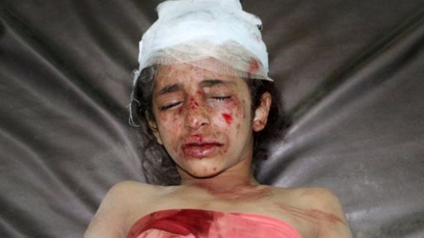 اليمن: انتهاكات واسعة لحقوق الاطفال فهل من محاسبة عليها؟