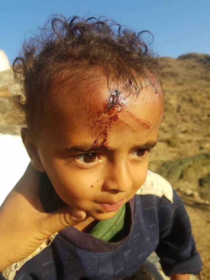 حجة : هجوم حوثي على تخوم حجور وإصابة أطفال بقصف على العبيسة