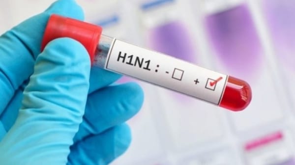 مكتب الصحة بتعز: وفيات بأعراض مشابهة لإنفلونزا الخنازير