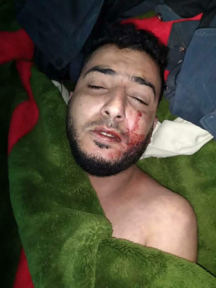 تفاصيل مقتل المغترب الشاب "عبدالملك السنباني" في لحج