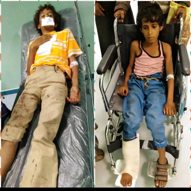 إصابة طفلين نتيجة قذيفة "هاون" بالضالع