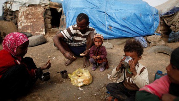 نازحو اليمن عرضة لانتشار الأمراض المستوطنة